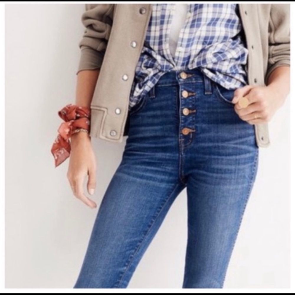 Madewell Button-Fly High-Rise Skinny Jeans